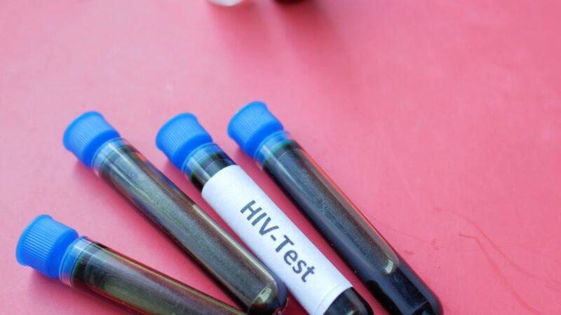 HIV Explained: Causes, Symptoms, Prevention & the Big Question—Is There a Cure?